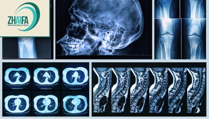 انواع رادیوگرافی انواع رادیوگرافی