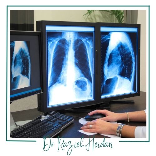 مزایای پرتونگاری مزایای پرتونگاری