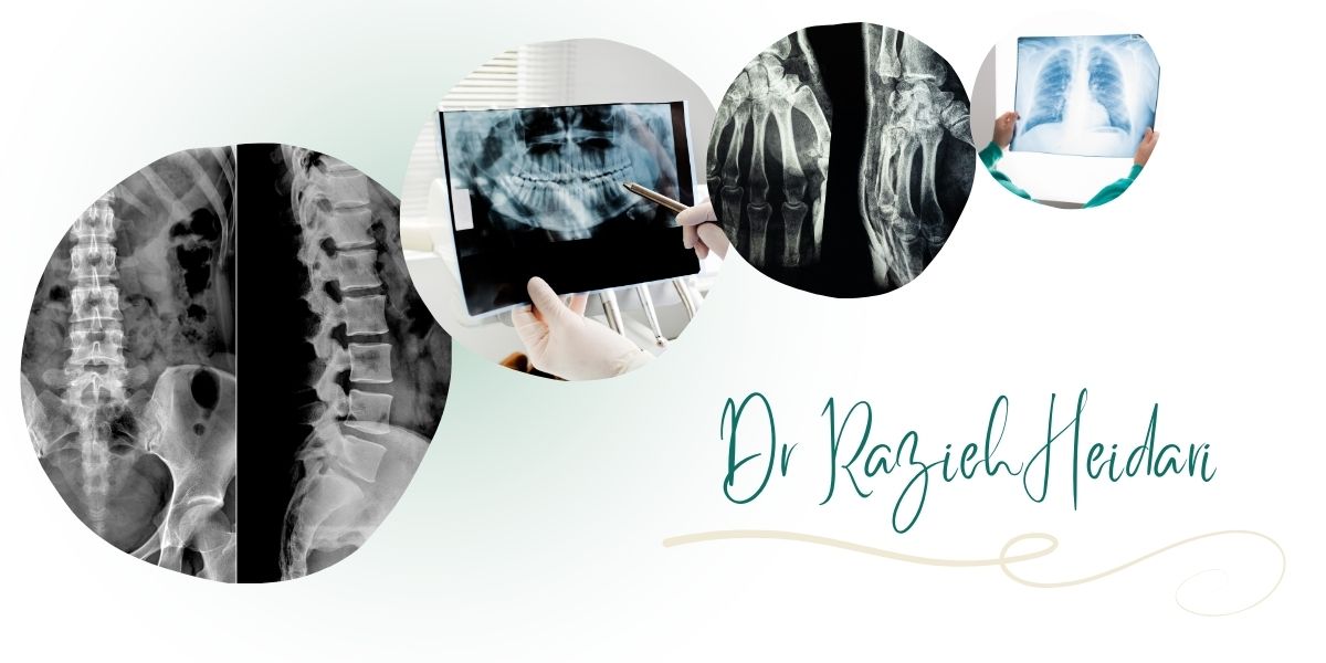 مرکز دکتر حیدری بهترین مرکز رادیوگرافی در شرق تهران مرکز دکتر حیدری بهترین مرکز رادیوگرافی در شرق تهران