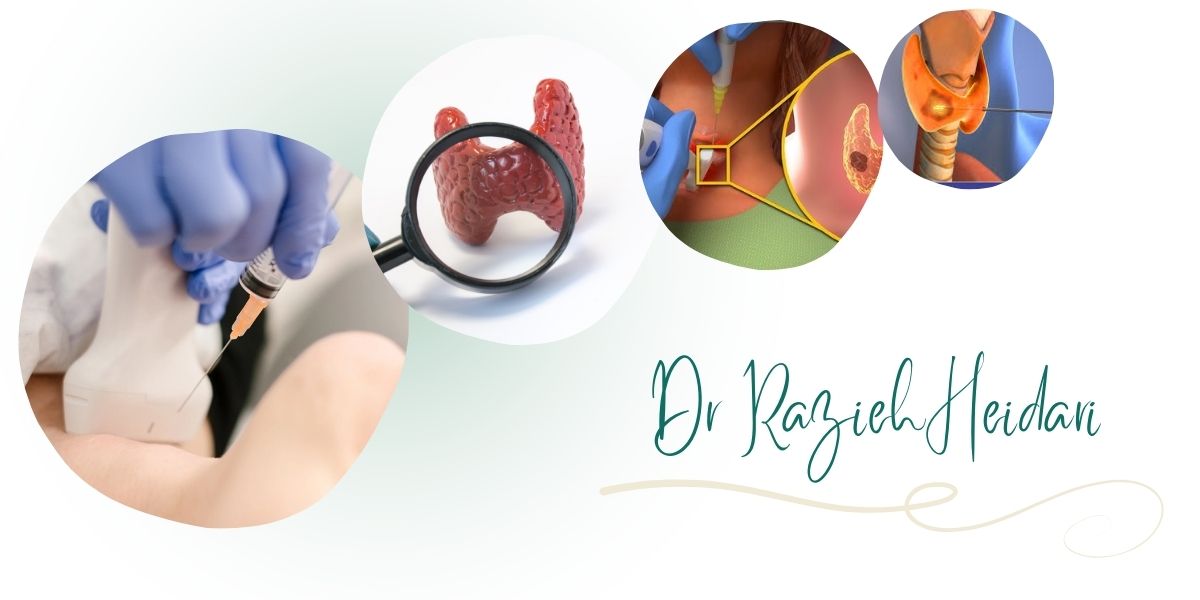 چرا دکتر حیدری بهترین متخصص نمونه برداری ندول تیروئید در شرق تهران است؟