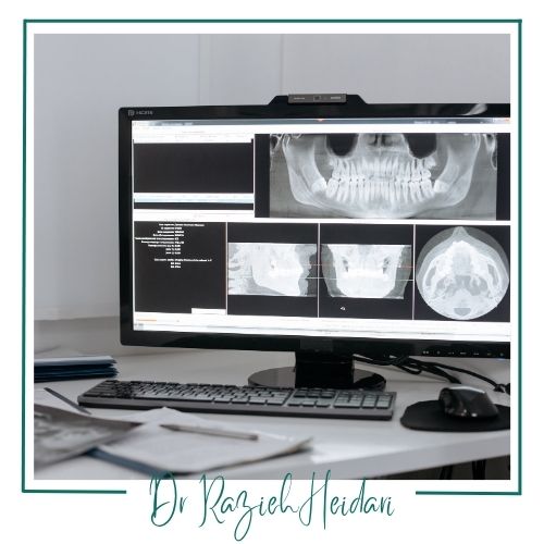 انواع مختلف عکسبرداری دندان انواع مختلف عکسبرداری دندان
