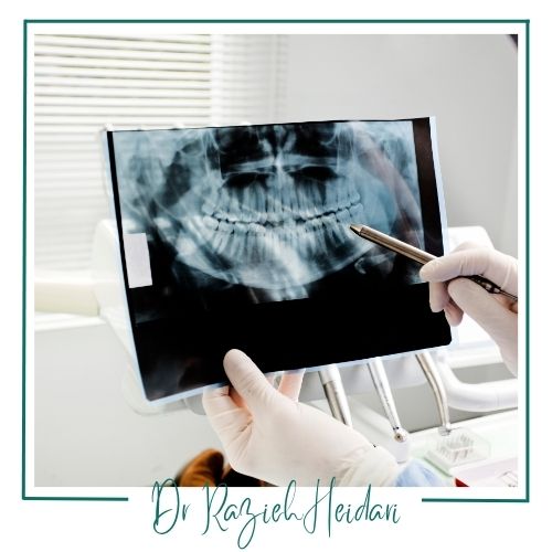 مزایای تصویربرداری OPG مزایای تصویربرداری OPG