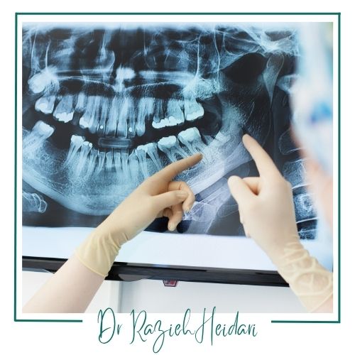 هزینه عکس پانورامیک دندانها و فک هزینه عکس پانورامیک دندانها و فک