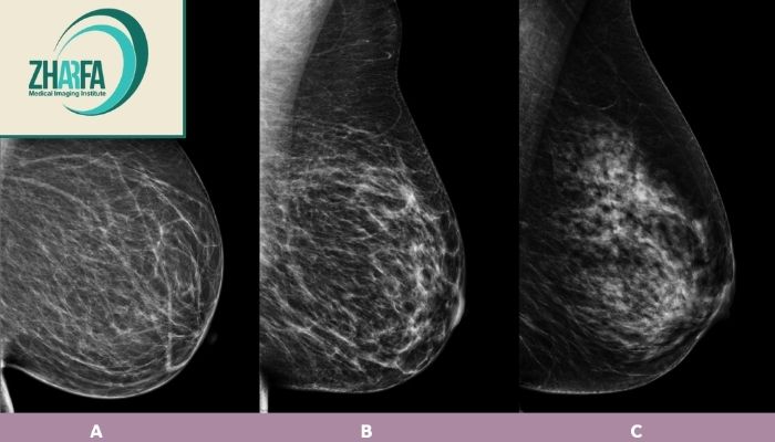 کدام روش تصویربرداری پستان را چه زمانی انجام دهیم؟