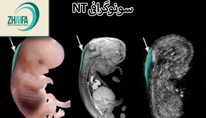 کاربردهای اولتراسوند NT