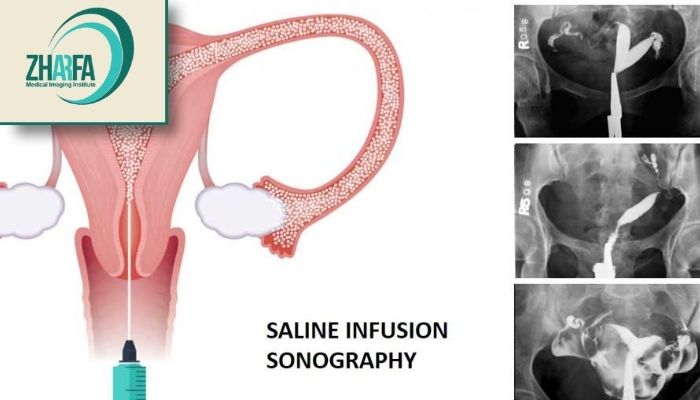 چه کسانی به عکس رنگی رحم نیاز دارند؟
