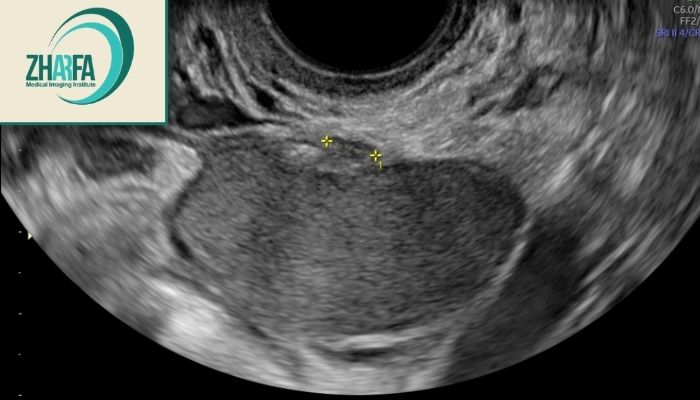 روش‌های تشخیص