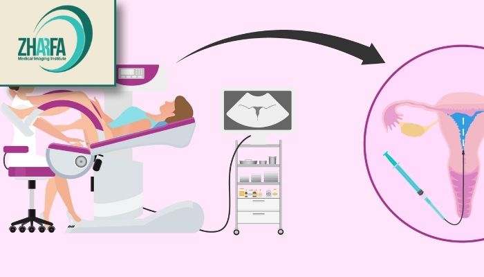 اقدامات بعد از عکس رنگی رحم اقدامات بعد از عکس رنگی رحم