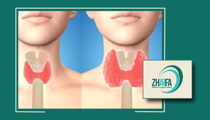 CNB ندول تیروئید چیست و چگونه انجام می شود؟ 