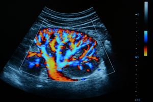 سونوگرافی کالرداپلر «رنگی» سونوگرافی کالرداپلر «رنگی»