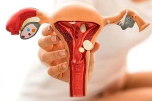 سونوگرافی آندومتریوز سونوگرافی آندومتریوز