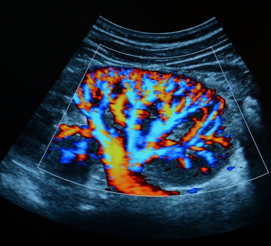 سونوگرافی کالرداپلر پستان