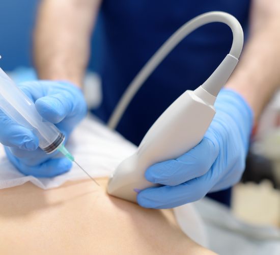 نمونه‌برداری FNA پستان