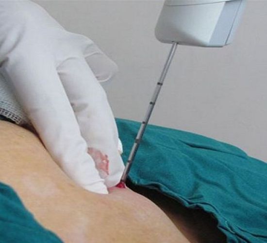 نمونه برداری پستان