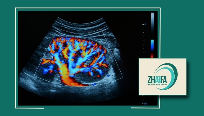 بهترین مرکز سونوگرافی کالر داپلر در پیروزی و شرق تهران بهترین مرکز سونوگرافی کالر داپلر در پیروزی و شرق تهران