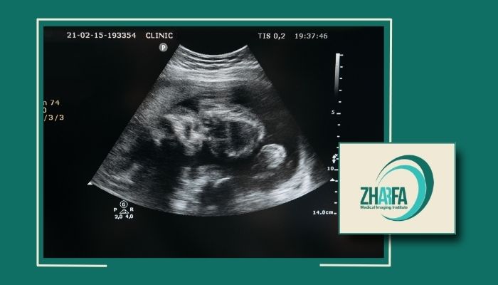 سونوگرافی آنومالی در پیروزی و شرق تهران توسط بهترین دستگاه