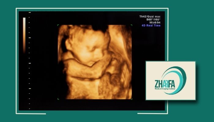 سونوگرافی سه بعدی در پیروزی و شرق تهران با نوین ترین تجهیزات