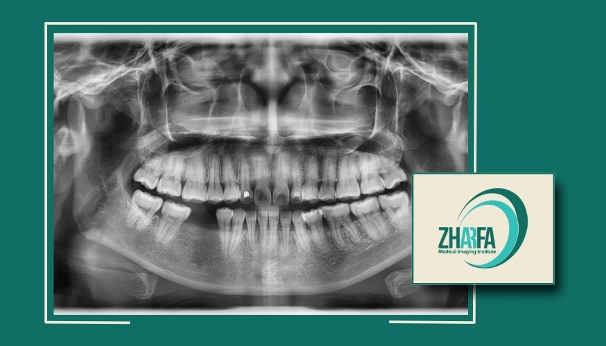 عکس OPG دندان در پیروزی و شرق تهران با بیمه عکس OPG دندان در پیروزی و شرق تهران با بیمه