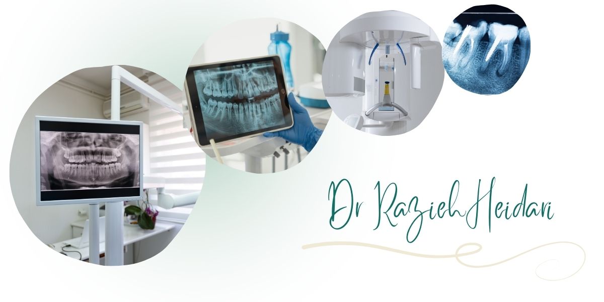 چرا مرکز دکتر حیدری بهترین مرکز عکس دندان و OPG در پیروزی و شرق تهران است؟ چرا مرکز دکتر حیدری بهترین مرکز عکس دندان و OPG در پیروزی و شرق تهران است؟