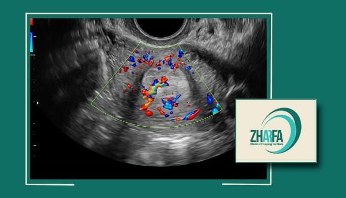 عکس رنگی رحم هر چند وقت یکبار باید انجام شود؟