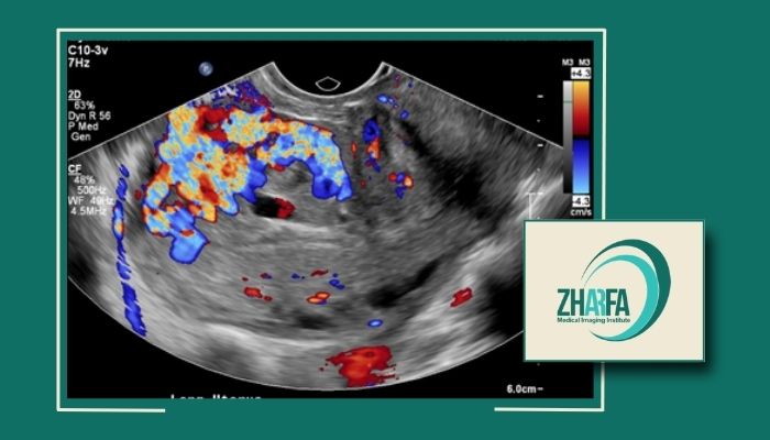 مراقبتهای بعد از عکس رنگی از رحم که باید انجام دهید