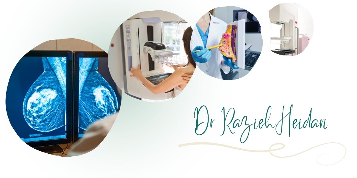 مرکز دکتر حیدری بهترین مرکز ماموگرافی پستان در پیروزی و شرق تهران مرکز دکتر حیدری بهترین مرکز ماموگرافی پستان در پیروزی و شرق تهران
