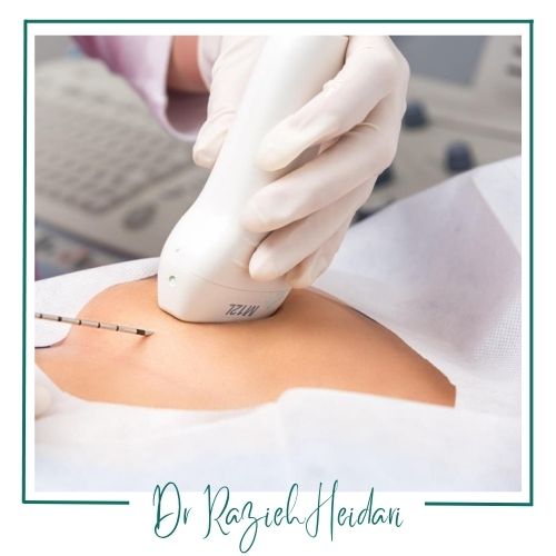 هزینه مارکرگذاری سینه هزینه مارکرگذاری سینه