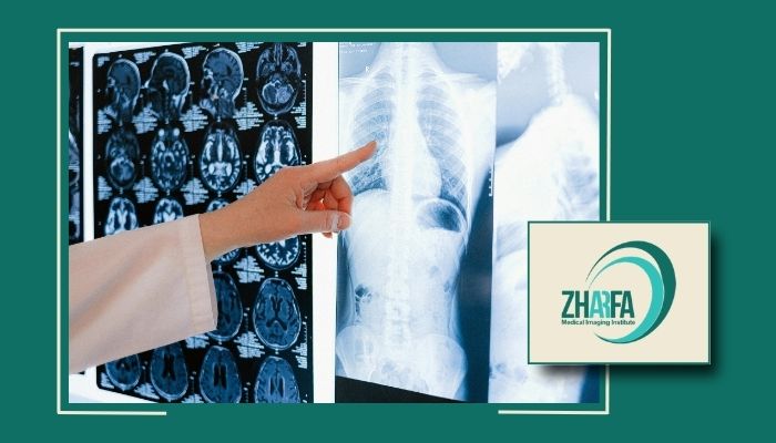 رادیولوژی چیست و چه خدماتی در مرکز دکتر حیدری ارائه می شود؟ رادیولوژی چیست و چه خدماتی در مرکز دکتر حیدری ارائه می شود؟