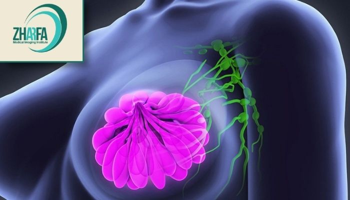 علائمی که نیاز به سونوگرافی غدد لنفاوی علائمی که نیاز به سونوگرافی غدد لنفاوی
