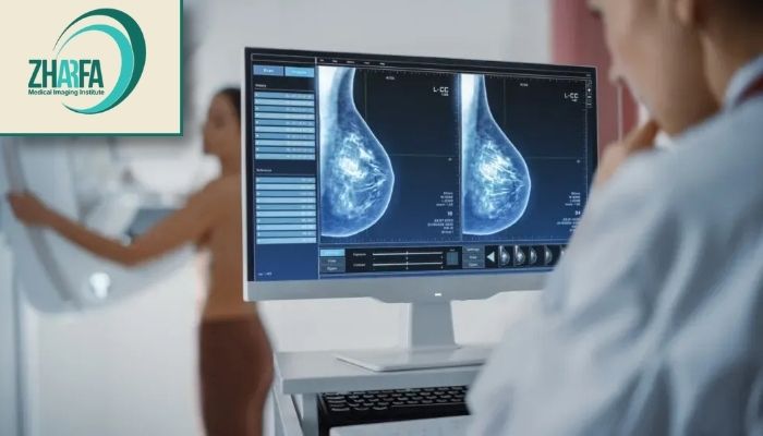 علائم ضروری برای انجام ماموگرافی علائم ضروری برای انجام ماموگرافی